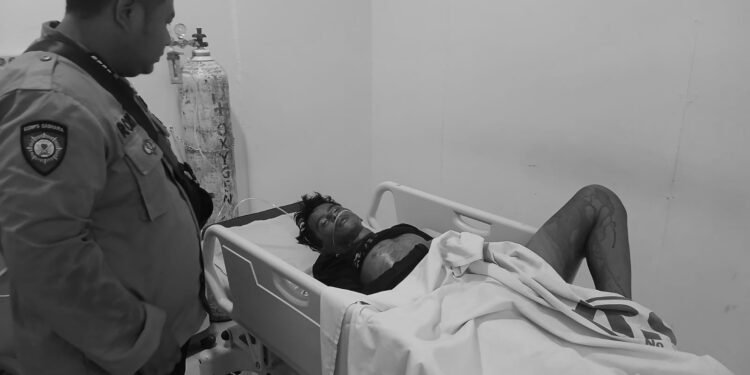 Remaja di Langkat Diserang Monyet Jenis Ekor Panjang, Alami Luka Serius