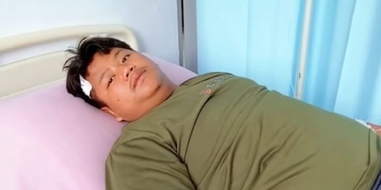 Pelajar di Kota Binjai Alami Luka Serius di Tangan Usai Dibegal saat Pergi Sekolah